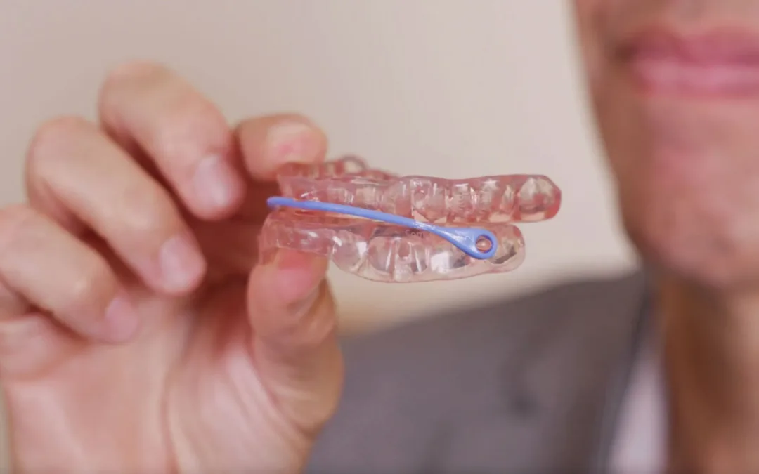 SomAccount: An innovative, embedded approach to Magento Development